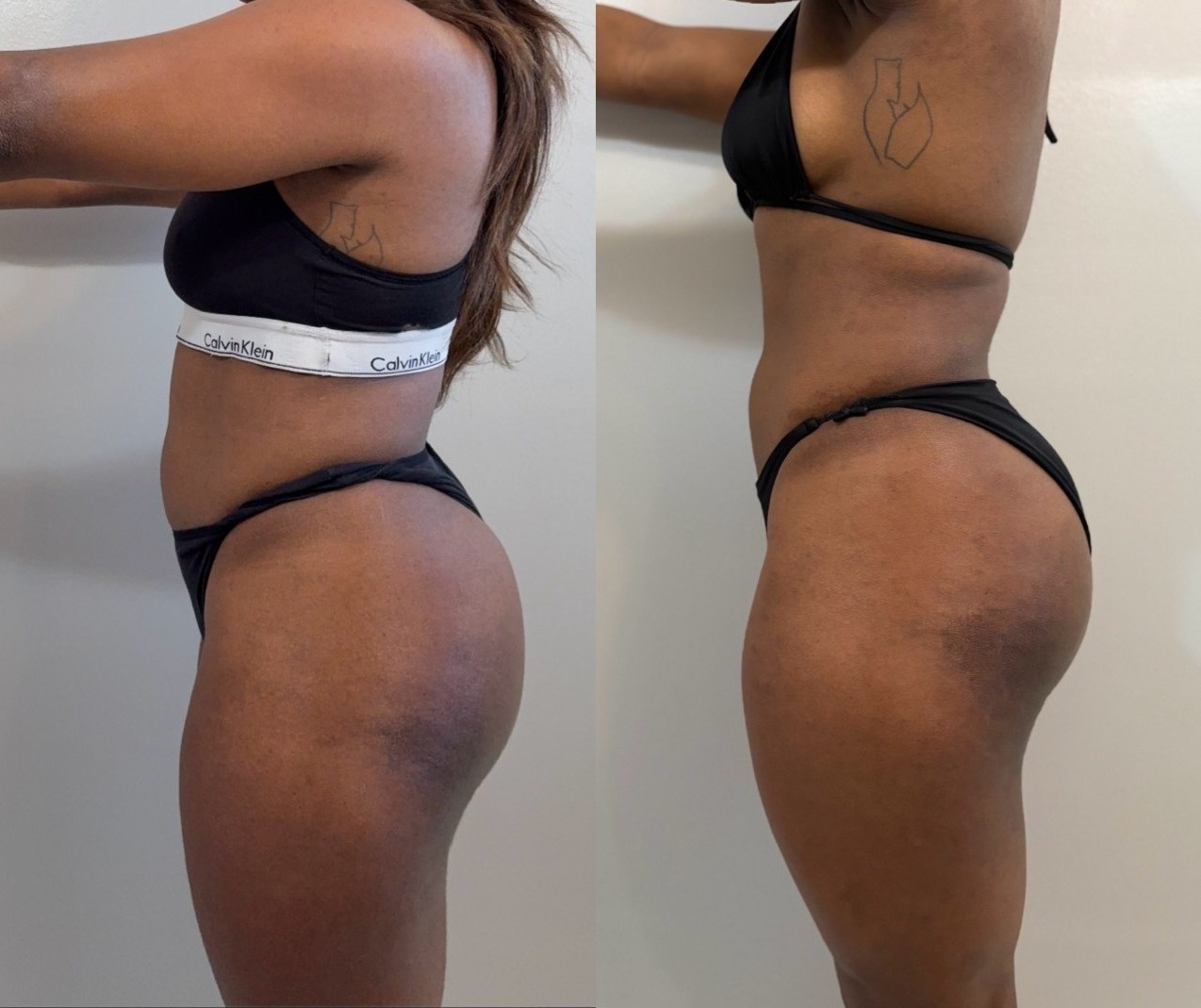 Janelle, 10 week transformation